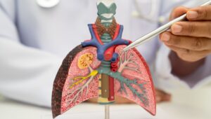 医師が肺の立体模型をペンで指しながら説明しているイメージ