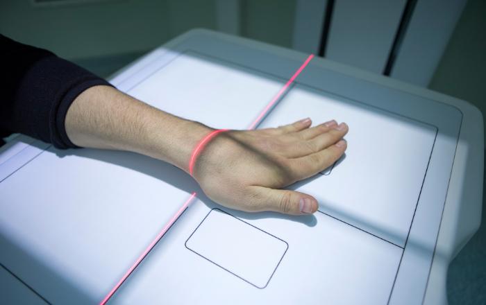 MD法による手のレントゲン検査のイメージ