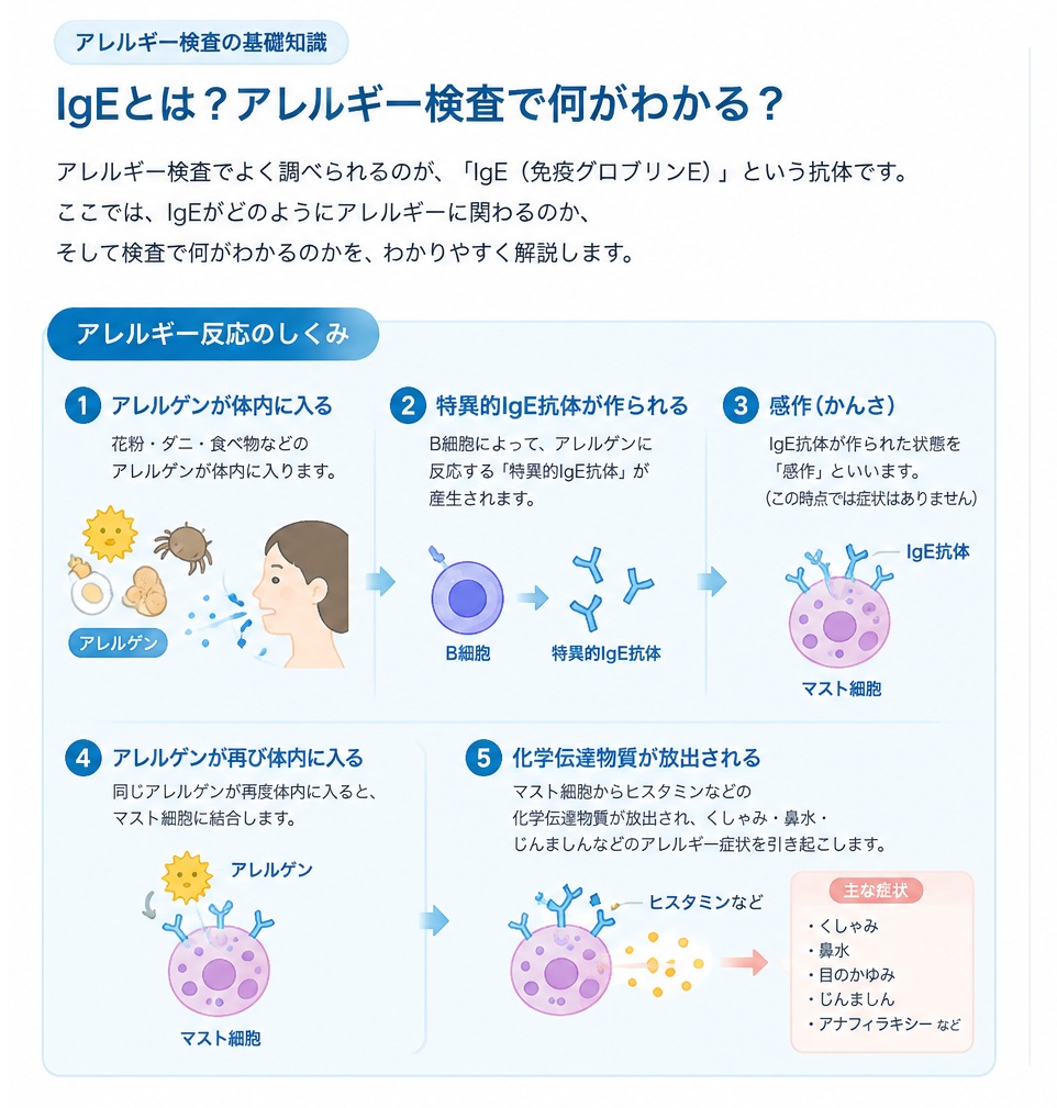 IgEとアレルギー反応のしくみ。